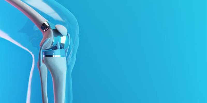 How Long Will a Hip or Knee Replacement Last?